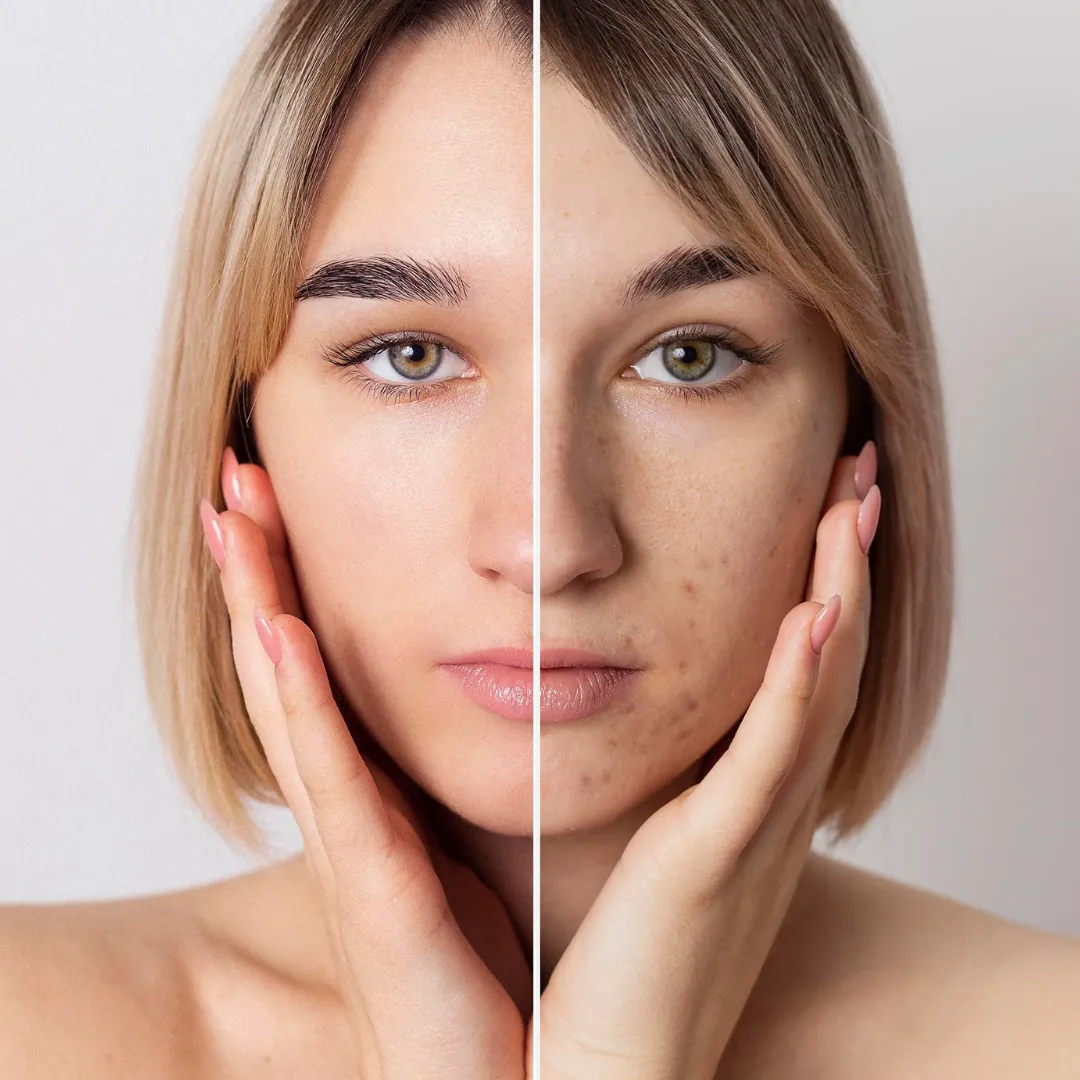 HONEY ZIP Agave Moisture Fit Mask